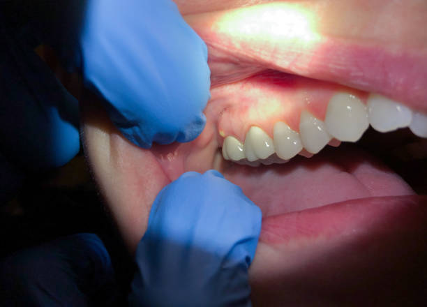 Best Urgent Dental Care for Toothaches in Moody, TX