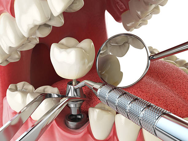 Best Walk-In Emergency Dental Services in Moody, TX
